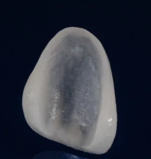 Veneer No Prep web
