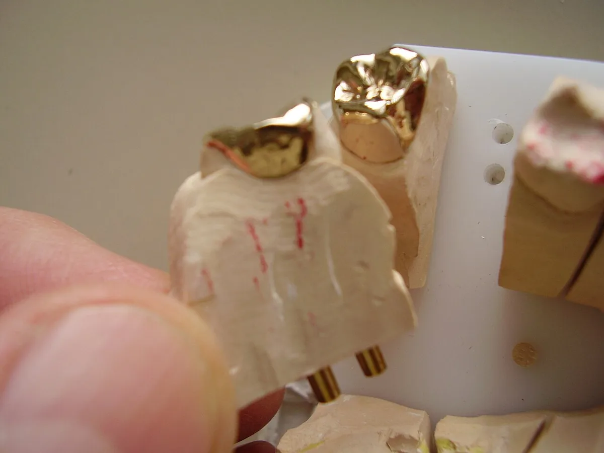 Inlay making 26